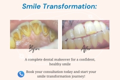 Darshil-Dental-Care-14-scaled