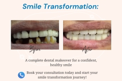 Darshil Dental Care - 2
