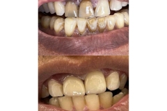 WhatsApp-Image-2026-04-22-at-7.23.04-AM-3