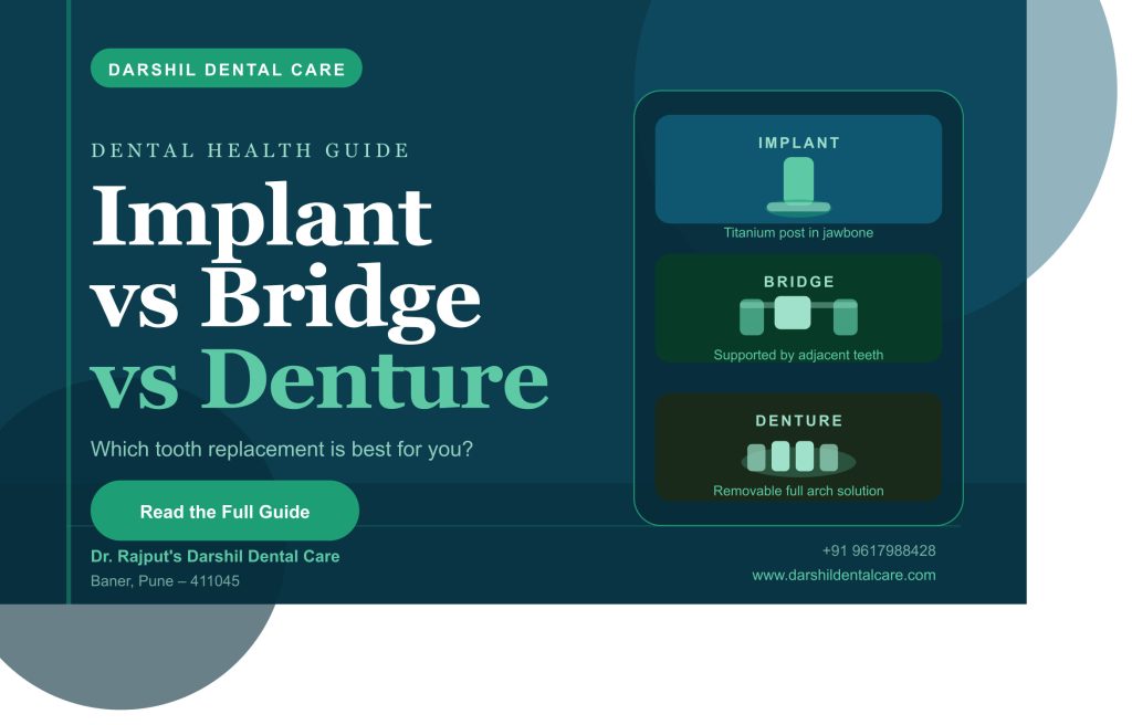 Dental Implant vs Bridge vs Denture – Which Is Best? | Darshil Dental Care Baner Pune