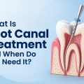 Root Canal Treatment in pan card clun road